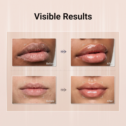 Lip Recovery Serum